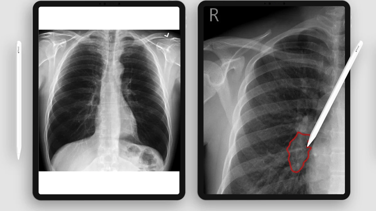 Image may contain: screenshot, black and white and medical imaging